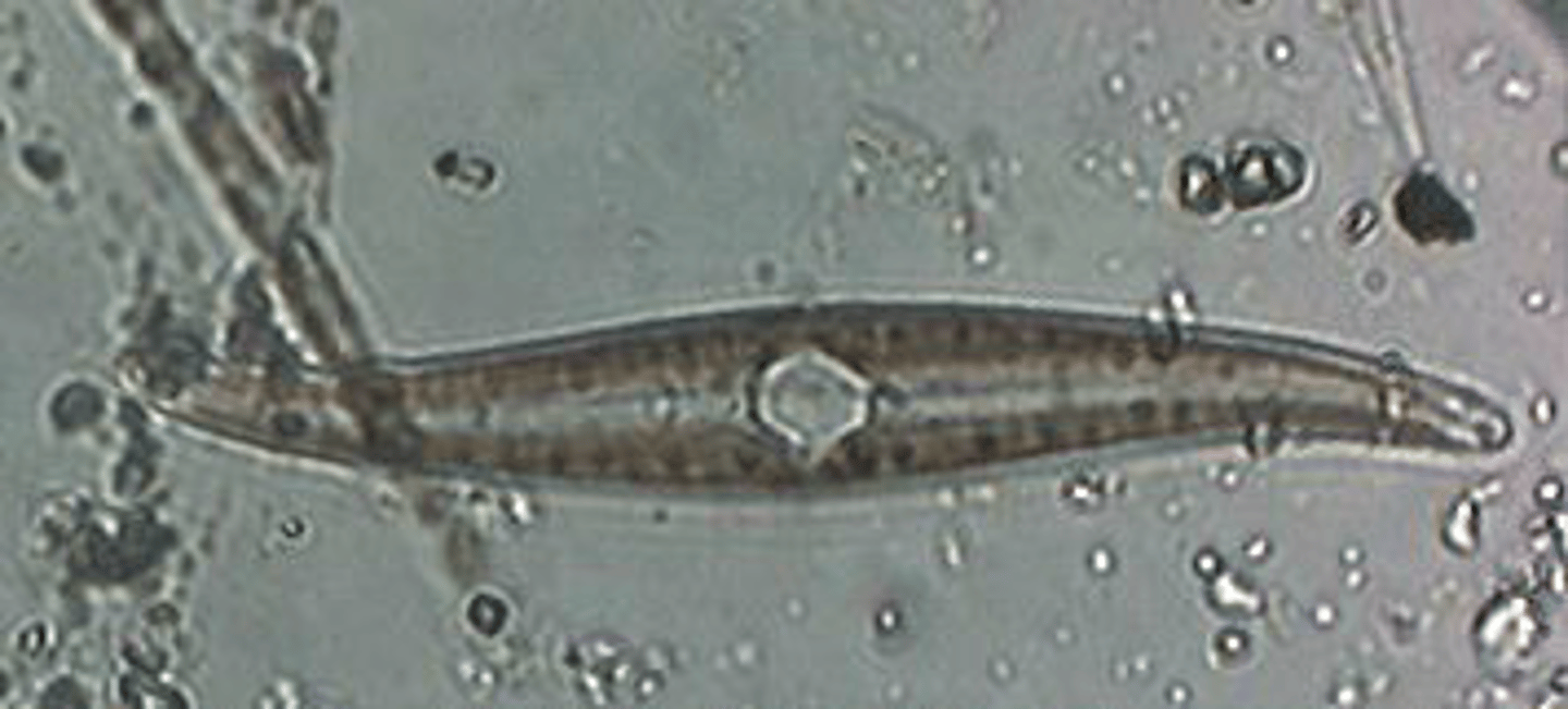 <p>Identify the freshwater Diatom shown</p>