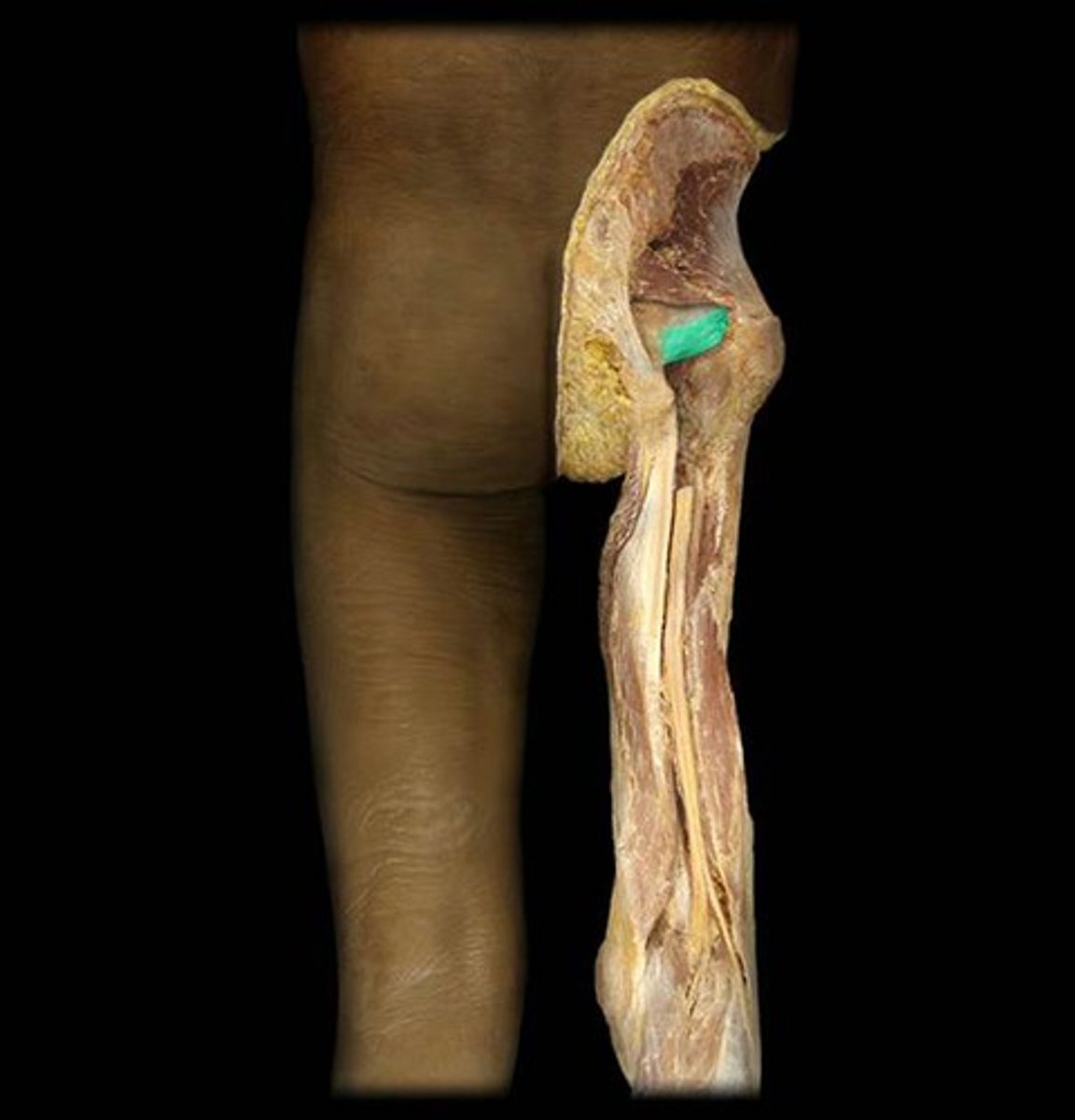 <p>Name this connective tissue structure.</p>