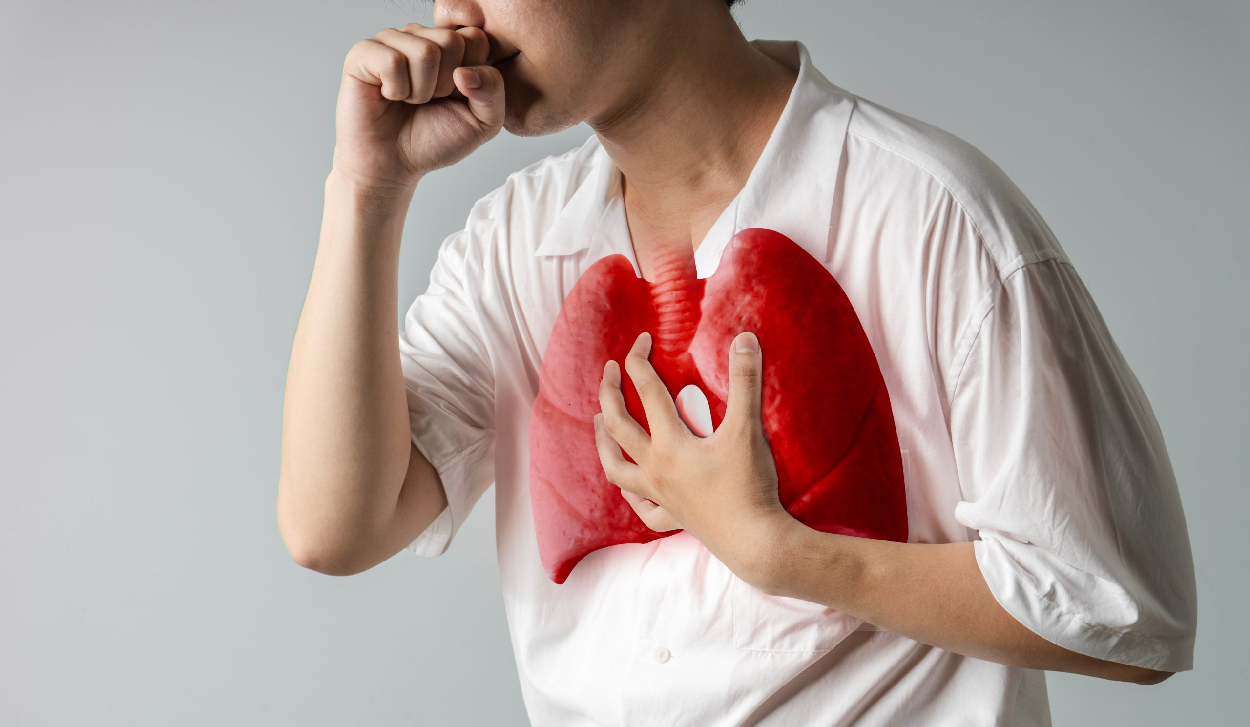 <p>How does hyperkinetic dysarthria affect respiration?</p>