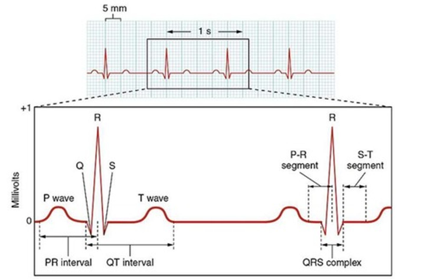<p>Electrocardiogram (ECG/EKG)</p>