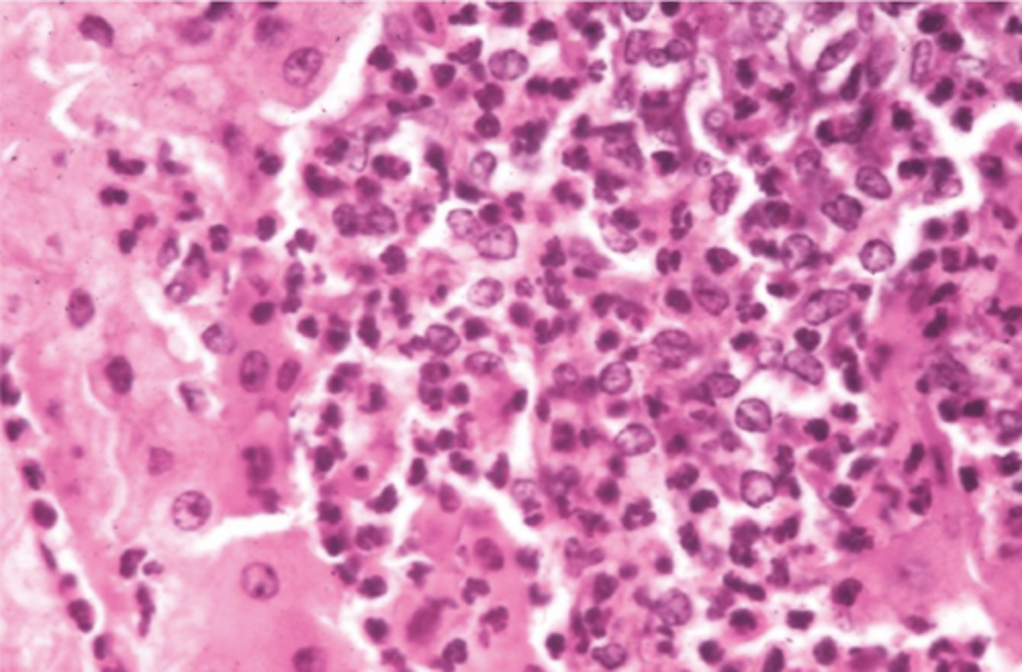 <p>hígado.</p><p>¿diagnóstico morfológico y etiológico?</p>