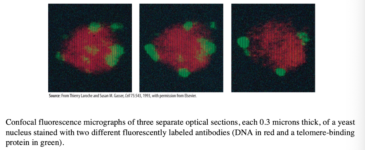 <ul><li><p>Produces an image of a thin plane located within a much thicker specimen</p></li><li><p>Solves thickness/image clarity issue in fluorescence microscopy</p></li><li><p>a laser beam is used to examine planes at different depth in a specimen</p></li><li><p>computer can compile images for 3-D modeling</p></li></ul><p></p>