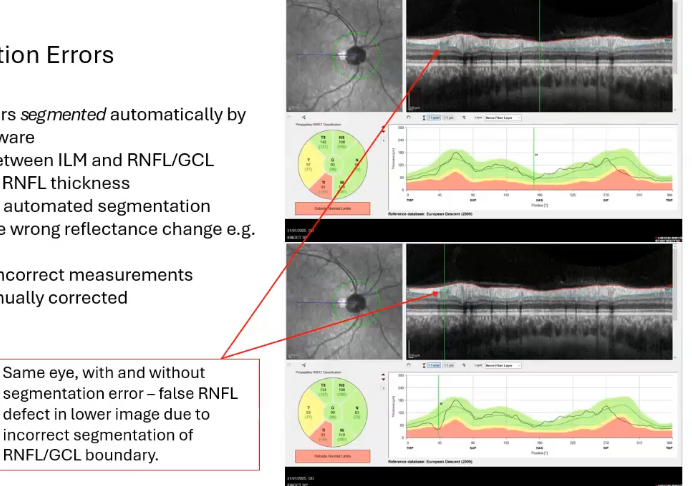 <p>segmentation errors </p>