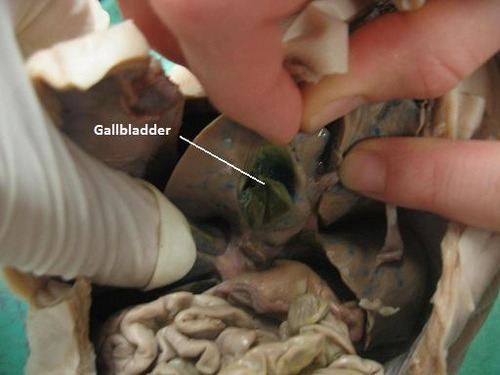 on the undersurface of the liver


A muscular sac attached to the liver that secretes bile and stores it until needed for digestion
