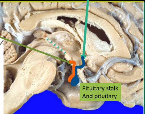<p>anterior commisure along lamina terminalis to optic chiasm</p>