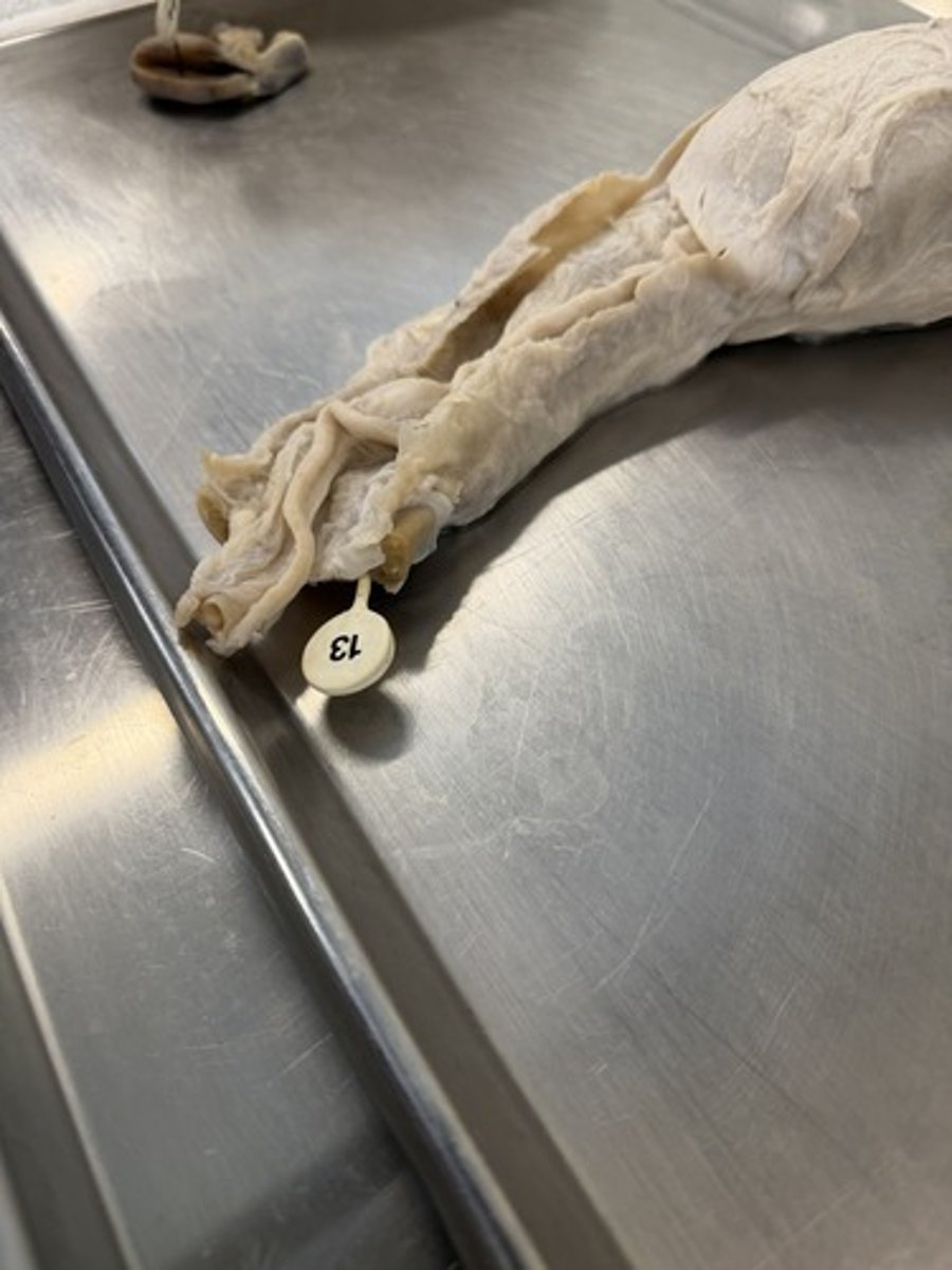 <p>a) What type of muscle is pierced by the pin?</p><p>b) What nerve innervates it?</p>