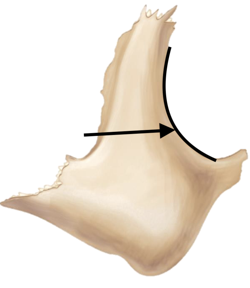 <p>Name the bone marking</p>