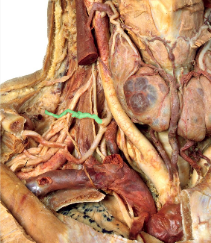 <p>Which artery?</p>