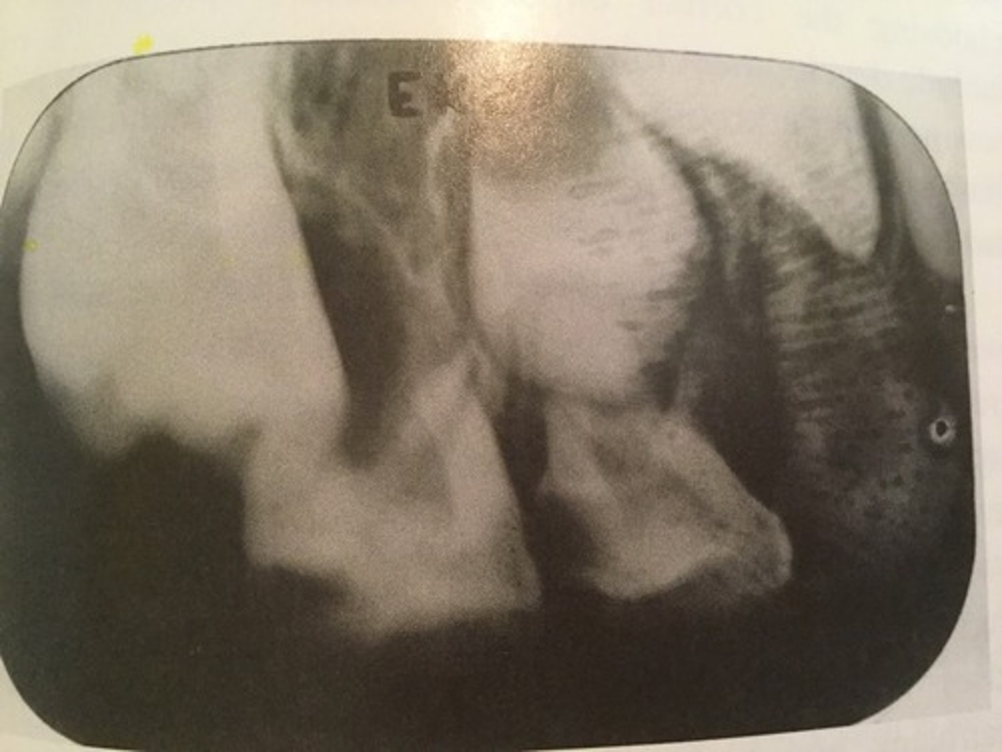 <p>Cause - Handling the film with damp fingers or damp latex gloves, or with residual glove powder on the fingers will leave black smudges</p><p>-Avoid contact with the surface of the film. Handle by the edges only!</p>