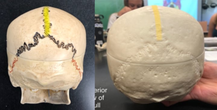 <p>Divides the two parietal bones from each other</p>