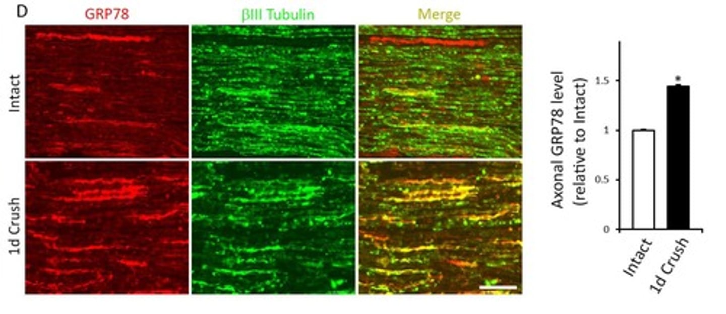 <p>Dual immunofluorescence was used to detect Luman and GRP78 in axonal structures.</p>