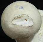 <p>a small, concave depression within the head of the femur that serves as an attachment point for the ligamentum teres</p>