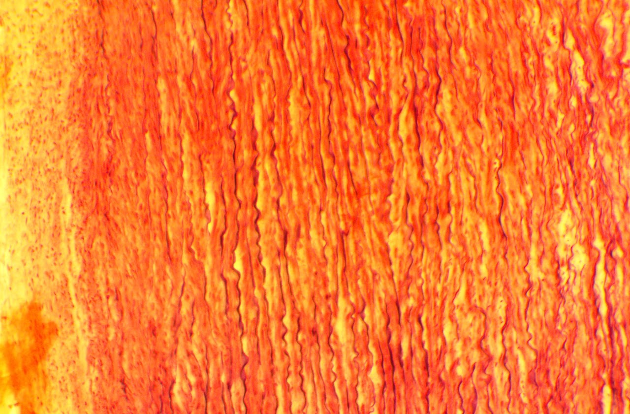 <p><span>Found in large arteries, such as the Aorta</span></p>