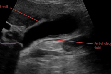 <p>What is this and what type of scan </p>