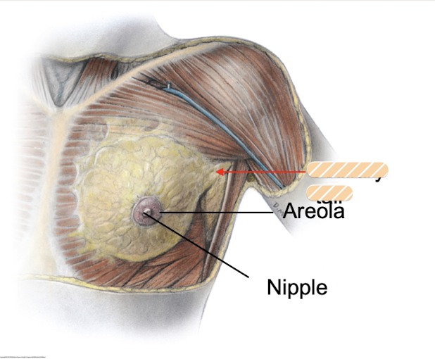 <p>part of breast that extends over pectoralis major muscle to the axilla </p>