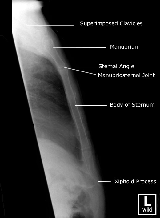 <p>Lateral sternum - Anatomy review</p>