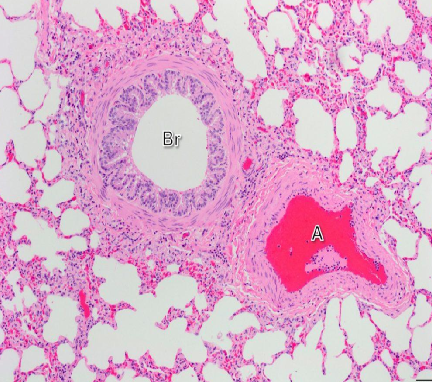 <p>Section showing<strong> bronchiole and alveoli (white spaces all around)</strong><br><strong>Red A = Artery</strong></p>