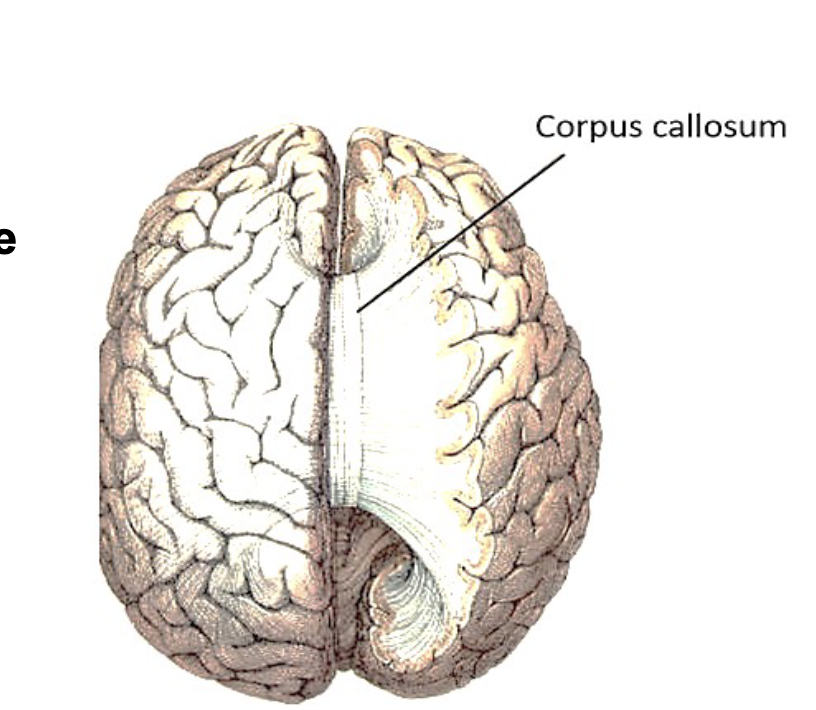 <p><span style="color: rgb(0, 0, 0);"><span>• Made of: commissural fibers - myelinated nerve fibers or tracts allowing communication from the one hemisphere to the other hemisphere<br>• Even though control of muscles and glands is mostly contralateral (= from opposite of brain), many brain functions require combination of processes from both the left and right hemispheres of the brain</span></span></p>