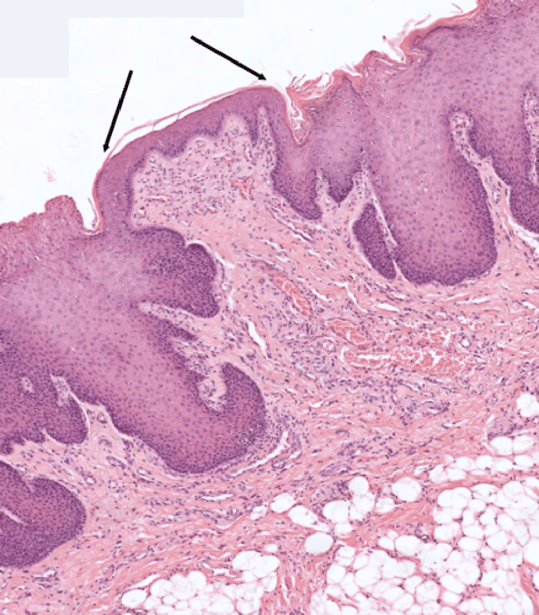<p>- the superior and lateral surfaces of the tongue are covered in papillae (bumps on the tongue)</p><p>- there are 4 types papillae (some containing taste buds)</p>