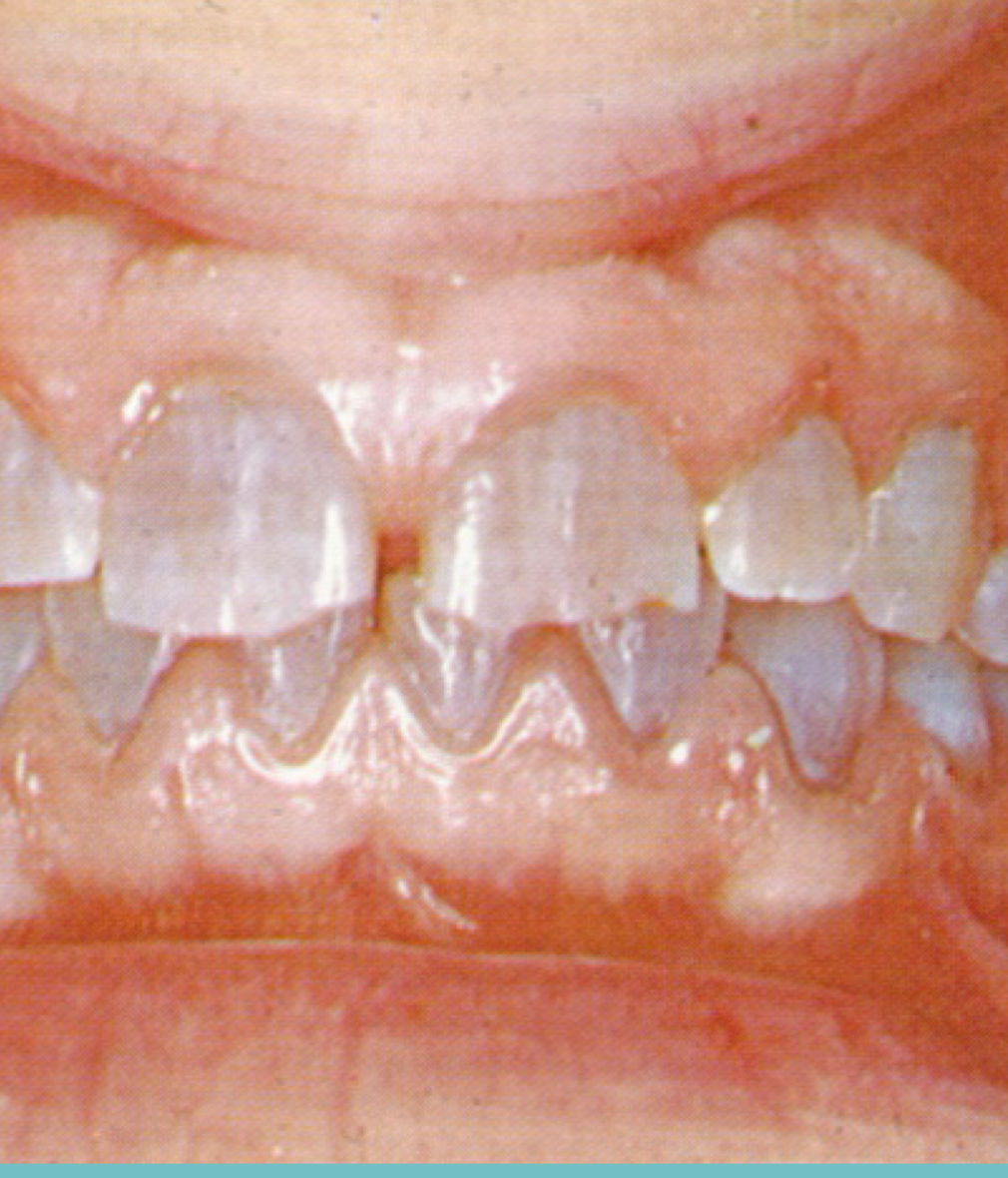 <p>Dentinogensis </p>