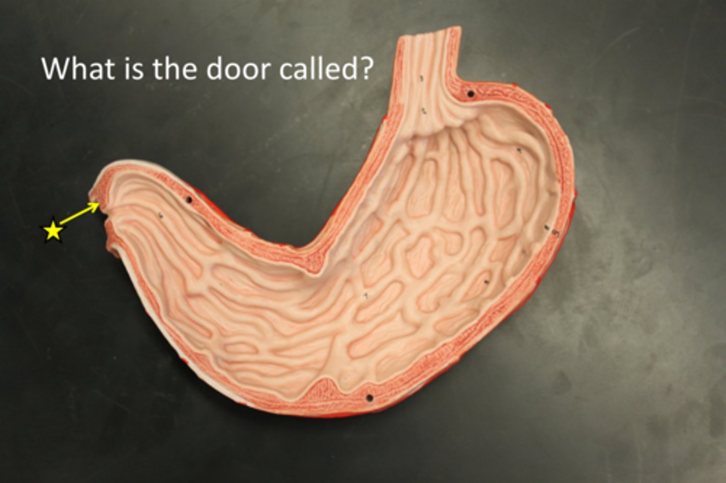 <p>A valve that controls the passage of food from the stomach to the duodenum.</p>