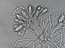 <p>Alternation of generations</p>