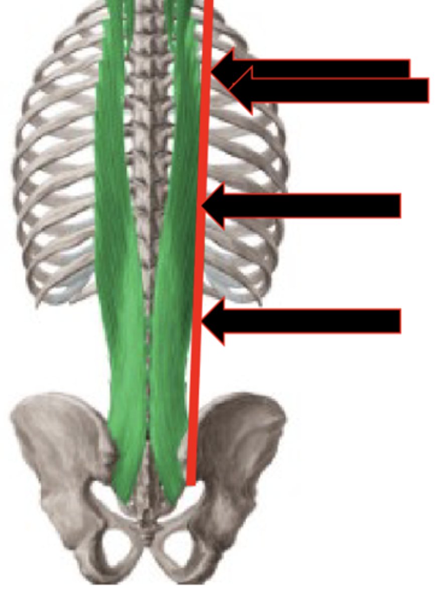 <p>Perpendicular deformation</p><p>- Define borders</p><p>- DO NOT move over muscle, just pushing it</p><p>- To see how well it moves</p>