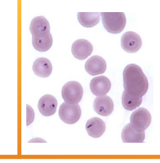 <p><span style="color: rgb(249, 247, 247);"><span><br> INTRAcellular – small “engagement ring” inclusions in RBCs, referred to as a “bejeweled ring” shape</span></span></p>