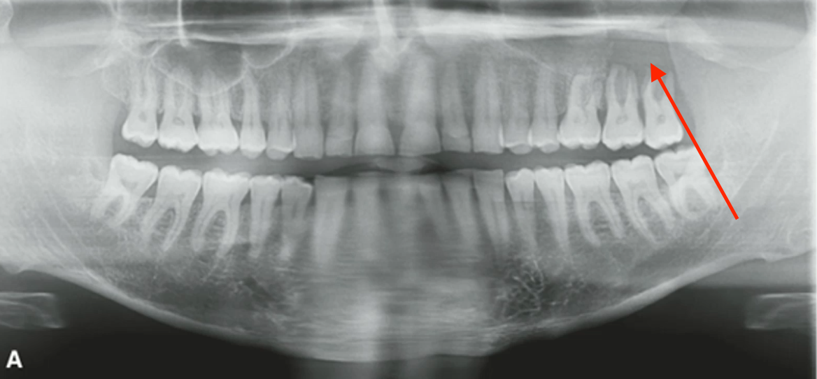 <p>most likely diagnosis? </p>