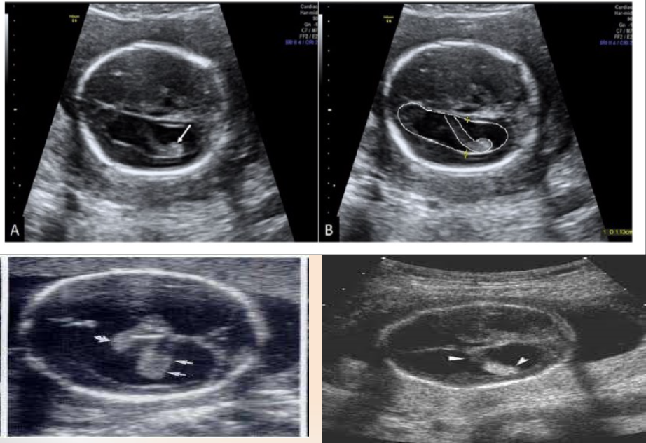 <p>What is this imaging showing?</p>