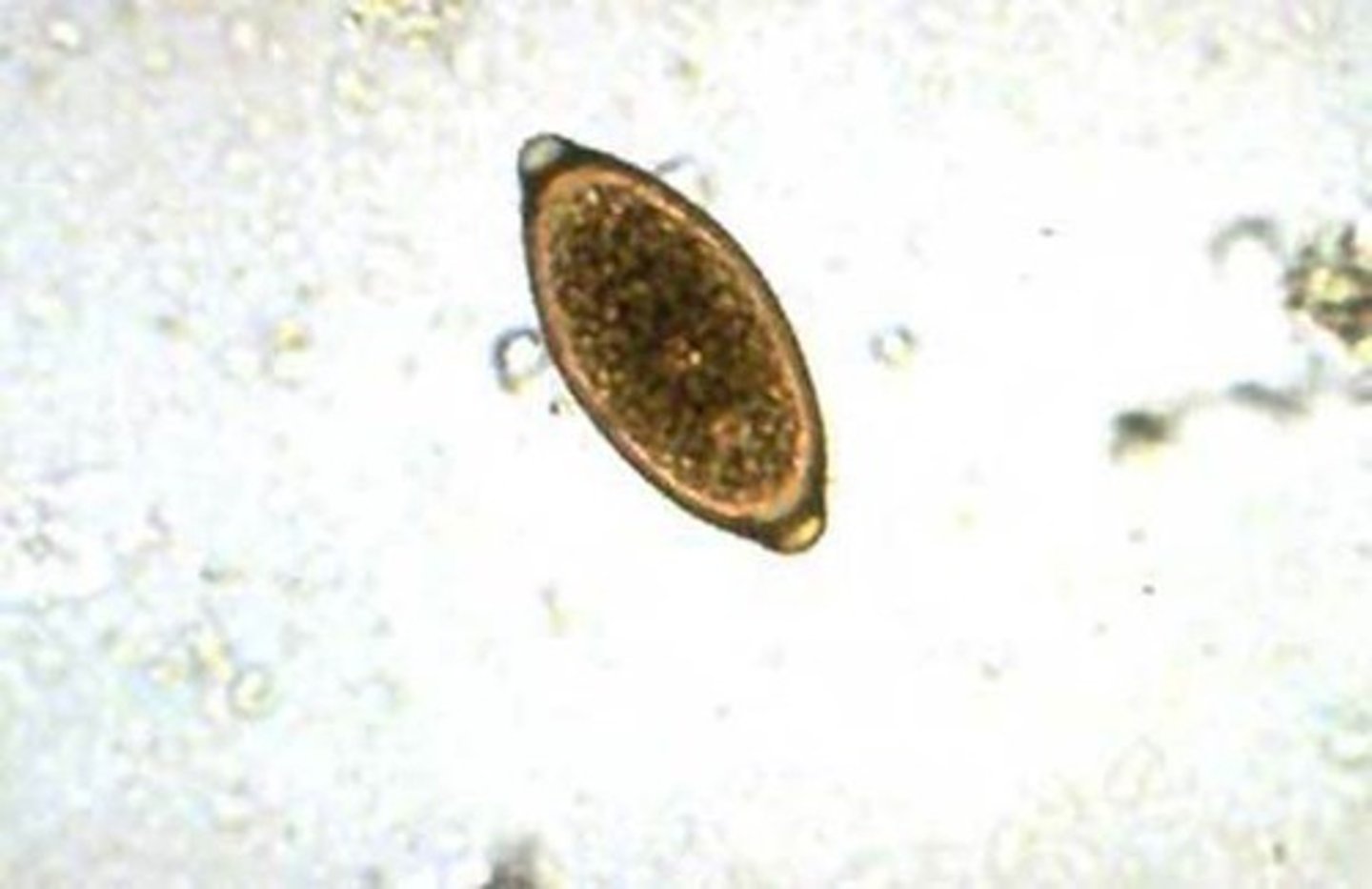<p>- Size: ~55 x 25 μm</p><p>- Elongate with distinct polar plugs</p><p>- Golden brown color</p><p>- Single-cell (uninfective) when passed in feces</p>