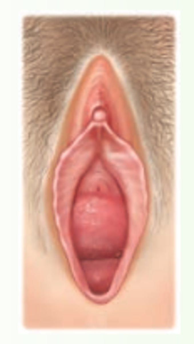 <p>a bulge of the upper two-thirds of the anterior vaginal wall with the bladder</p>