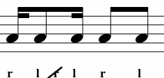 <p>What Variation is This? </p>