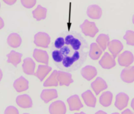 <p><span style="color: rgb(240, 234, 234);"><span>causes granulocytotropic anaplasmosis (WBCs);</span></span><span style="color: rgb(249, 235, 235);"><span>&nbsp;Fever, muscle pain, fatigue, nausea, joint pain, lameness, vomiting, bleeding disorders</span></span></p>