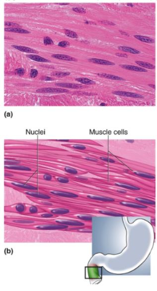 <p>Short fusiform Cells overlapping each other; nonstriated; one nucleus per cell, centrally located</p>