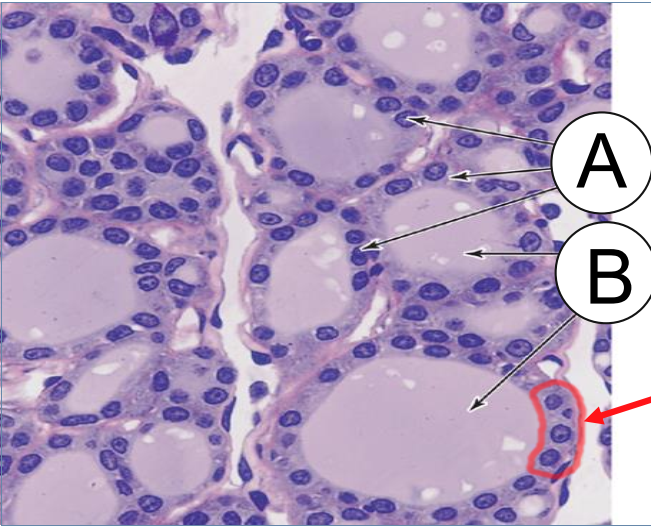<p>THIS RED ARROW IS POINTING “RED CIRCLE MIGHT NOT BE AVAILABLE IN REAL EXAM DON’T RELY ON IT”</p>