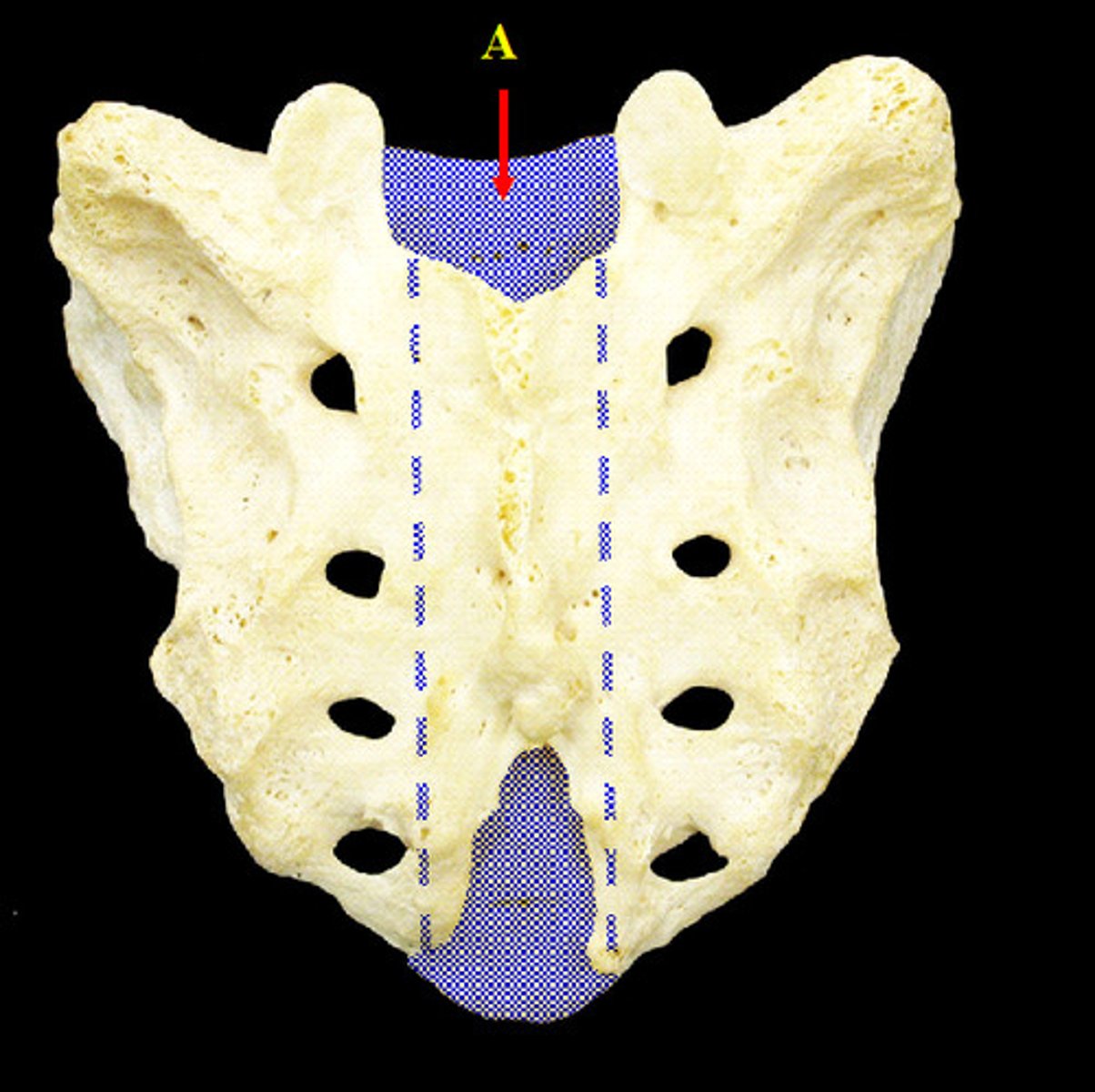 <p>Continuation of the vertebral canal that goes inside the sacrum and terminates near the coccyx via an enlarged opening called the sacral hiatus.</p>