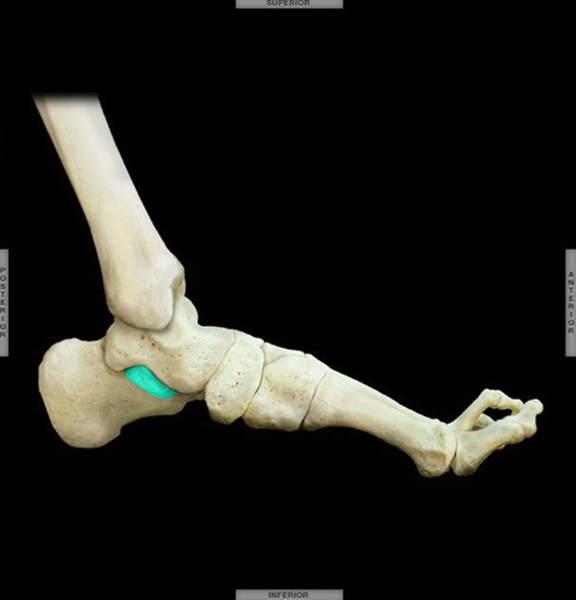 <p>small protrusion on the medial side of the calcaneus.</p>