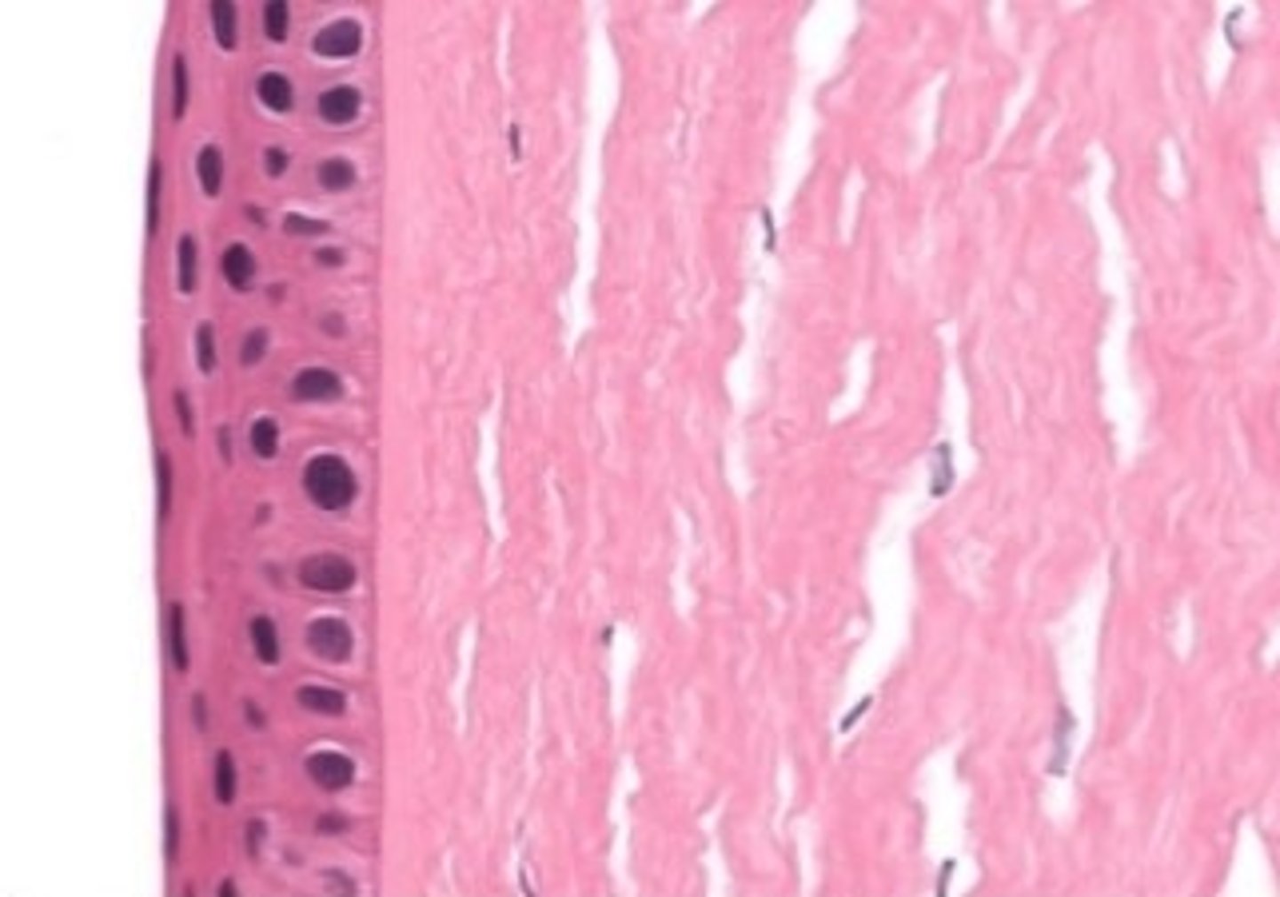 <p>anterior surface of the cornea</p>