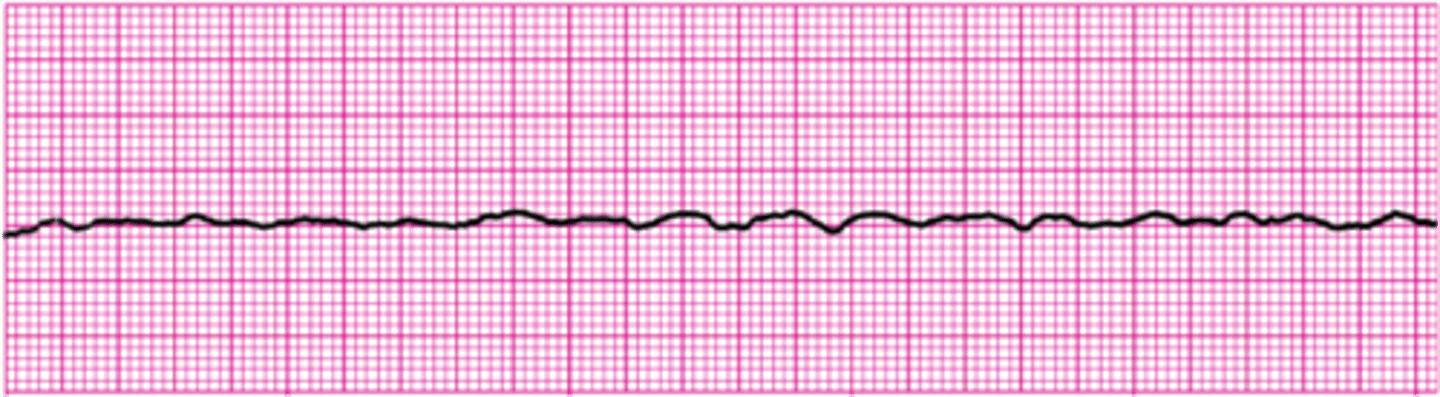 <p>Fine and fibrillatory</p>