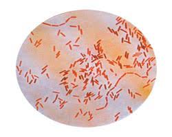 Salmonella typhi