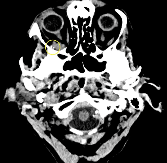 term image