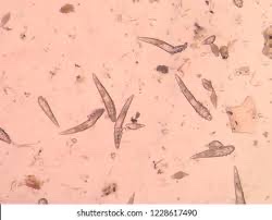 <p>These were found on the skin scrape of a puppy.</p>
