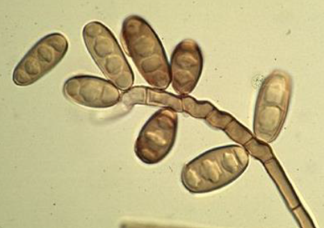 <p>This fungus can be a contaminant but can cause infections in the lungs, skin and eyes. What is the identity of this organism?</p>