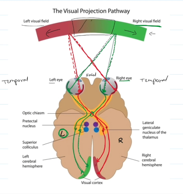 <ul><li><p>Each eye has two visual fields: One on the temporal side, the other on the nasal side.</p></li><li><p>The temporal side remains on the side of the brain, and the nasal side switches over.</p></li><li><p>Temporal side handles peripheral vision from the opposing visual field. Nasal side handles direct vision from the correlated visual field.</p></li><li><p>An issue with the optic chasm results in loss of direct vision. An issue with the temporal side results in loss of peripheral vision.</p></li></ul><p></p>