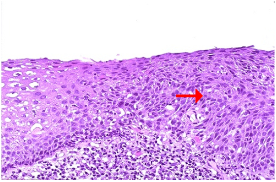 <ol><li><p>Identify</p></li><li><p>What is the pointed structure?</p></li></ol><p></p>
