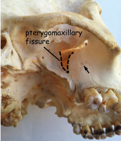 <p>posterior superior alveolar nn.</p>