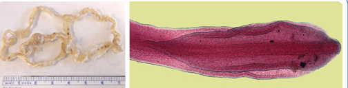 <p> </p><p>This is the broad fish tapeworm, a wide flat, ribbon-like pseudotapeworm that uses fish as the second intermediate host and can infect dogs as the definitive host.</p>