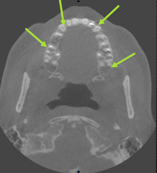 <p>which arch is this </p>