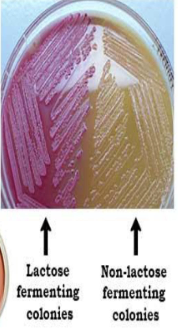 <p>Macconkey’s Agar&nbsp;</p><p>Type, what it’s used for,&nbsp;</p>